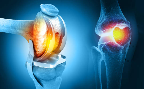 Cutting-Edge Robotic Joint Replacement at Livasa Amritsar - Revolutionary Technology